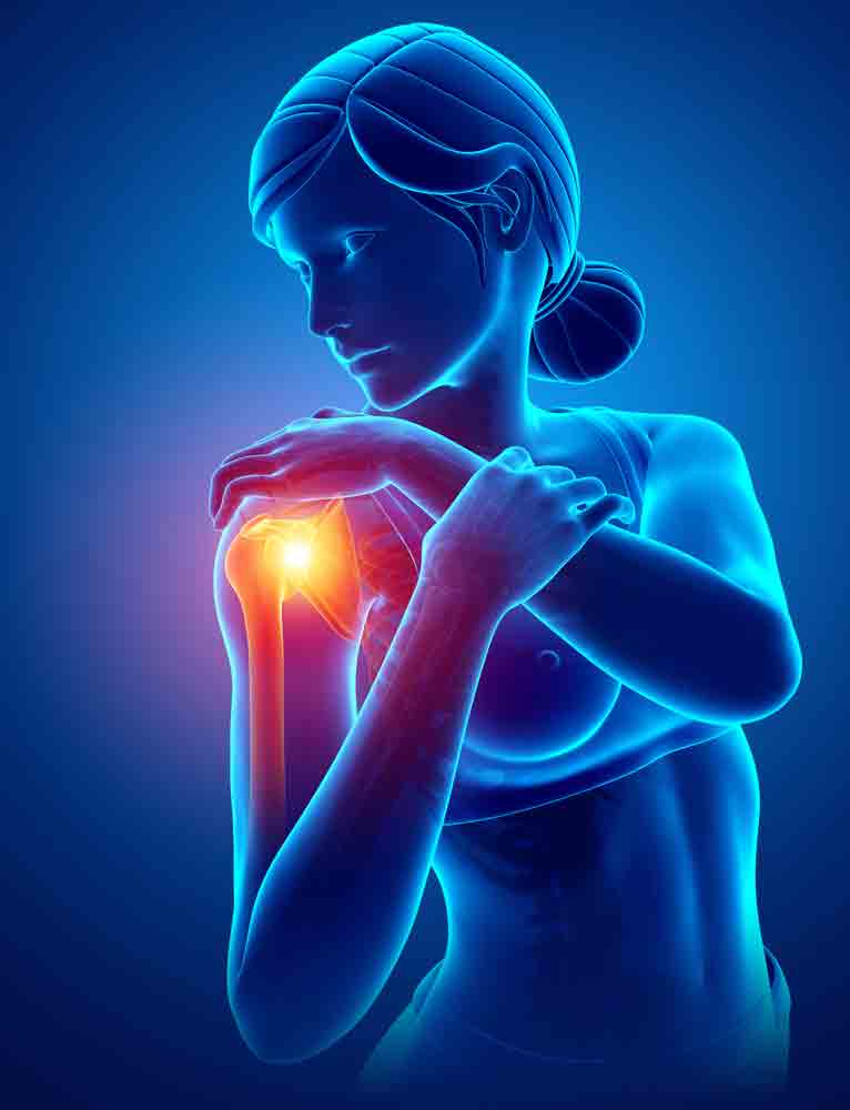 Understanding Shoulder Impingement Syndrome shoulder pain oakland physical therapy 598778627 1 Understanding Shoulder Impingement Syndrome