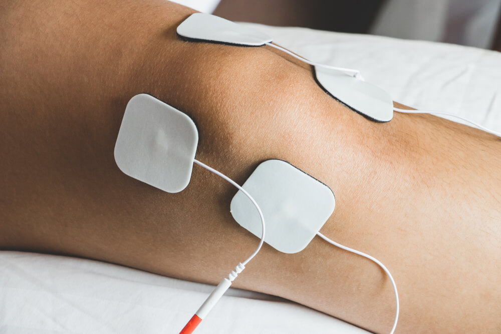 Electrical Stimulation Therapy
